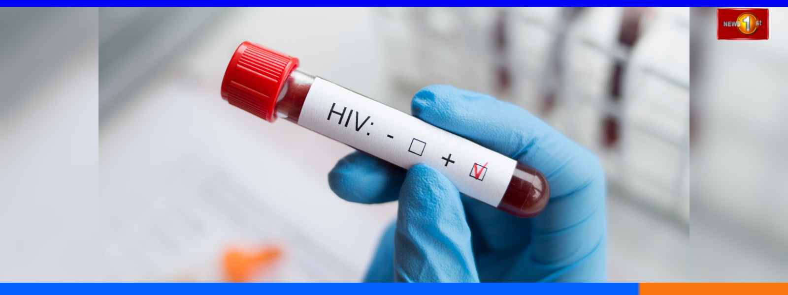 වසරේ මුල් මාස 6 තුළ නව HIV ආසාදිතයින් 238ක්...